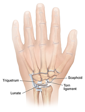 Wrist Arthroscopy Conditions Treated   477730.img