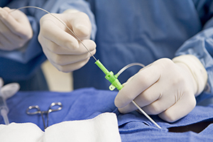 Closeup of gloved hands doing cardiac catheterization.